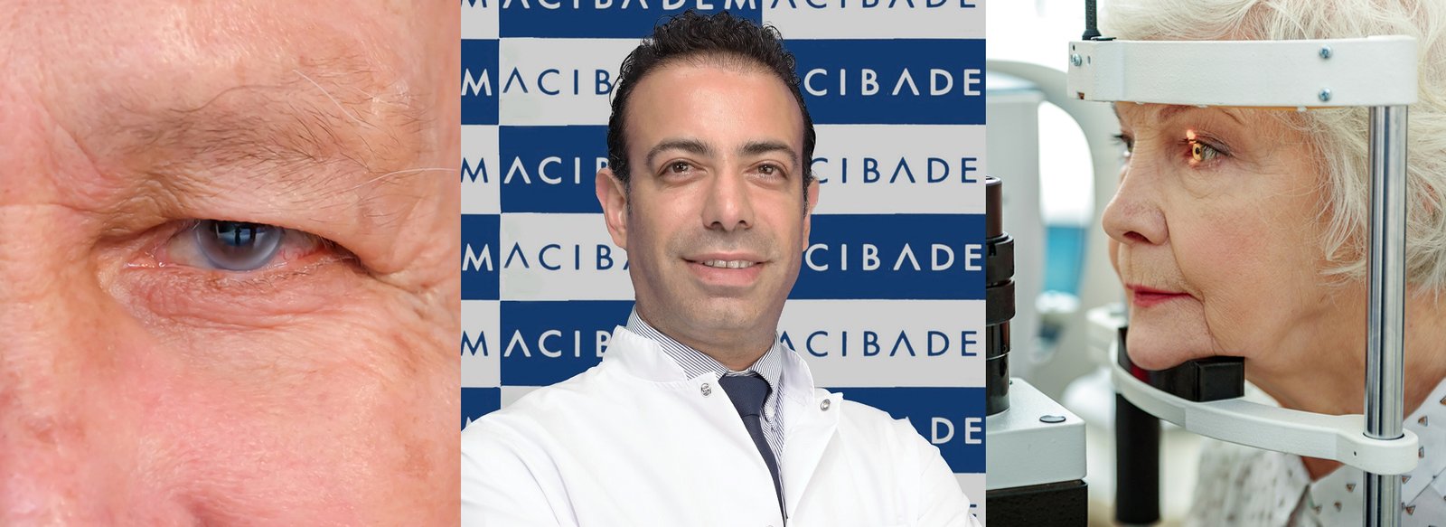 Glokom göz tansiyonu erken tanı ile önlemek mümkün! dr. muhsin eraslan (6)